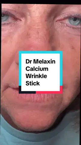 Dr Melaxin Calcium wrinkle core stick is what really works! #smokerlines #crowsfeet #drmelaxin #skincareover50 #tiktokshopcreatorpicks 