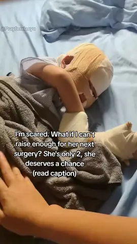 We need help urgently. Donate if you can the campaign link is in our bio. If you can't, sharing or commenting could save her life. our 2-year-old baby girl is fighting for her life. She suffered severe burns on 70% of her body caused by someone who was supposed to be family. She cries in pain every time her bandages are changed. She's scared and barely holding on. We've started a fundraiser for her treatment the bills are rising faster than we can manage. The campaign is linked in the bio So please if you're reading this, help us by liking, commenting, saving, or sharing. Even if you can't donate, helping us be seen could bring us one step closer to saving her. Thank you #youarenotalone #womensupportingwomen #feminineenergy #womenrights #feminism 