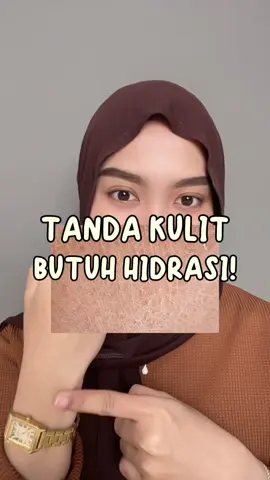 Kulit butuh hidrasi? Pakai Zaitun Oil aja bes!🫶🏻 #AzaleaBeauty #BestieHijabers #KulitBersisik #KulitKering #ZaitunOil 