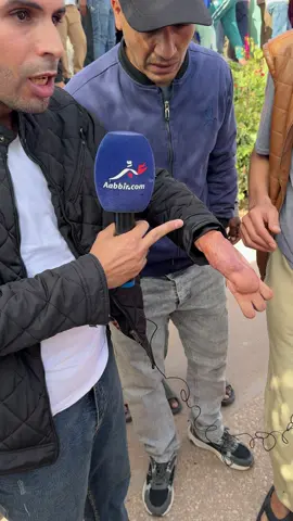 #agadir #hopital_hassan_2_agadir #شعب_الصيني_ماله_حل😂😂 هذا هو الحال في مستشفى الموت في أكادير 
