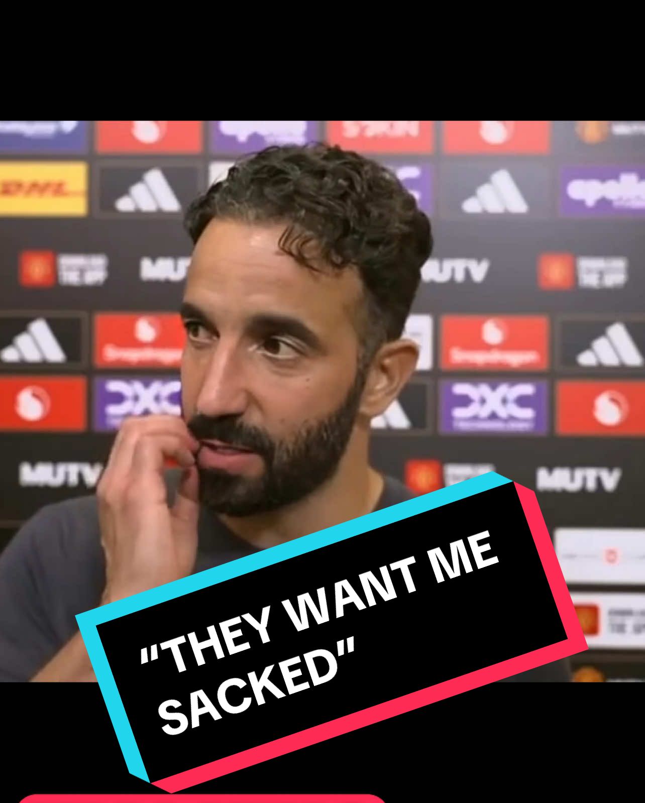 “Sesko is the Worst Signing Ever!” – Ruben Amorim BLAST His Players After City Defeat - Post Match Interview #manchesterunited #manchesterunitedfc #manunited #manunitedfc @DangerousAI @tiktok creators @TikTok Trends @Creator League #manunitedfans #rubenamorim #sesko #mbeumo #viral #viralvideo #viraltiktok #fyp #fypシ #fypシ゚viral #foryoupage #PremierLeague #epl #whattowatch #goviral #creatorsearchinsights 