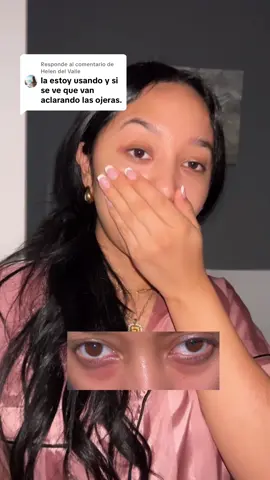 Respuesta a @Helen del Valle @COSRX US #TikTokShopRestock #ojeras #ojerastips #bolsasenlosojos #parchesdehidrogel 
