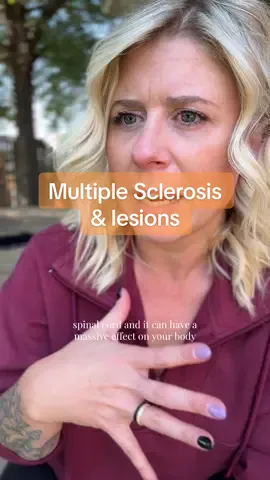 There is a reason Multiple Sclerosis is called the snowflake disease. It can be different in everyone. The CNS is such a complex thing, don’t get hung up on how many lesions you have. Where lesions are, are the thing. #multiplesclerosis #msawareness #chronicillness #chronicfatigue #creatorsearchinsights 