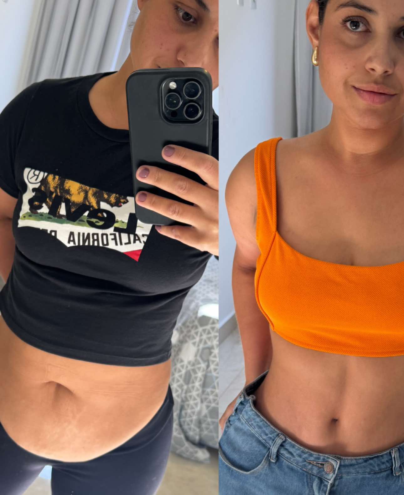 #viral #abdominoplastia #emagreci #emagrecimentofeminino 
