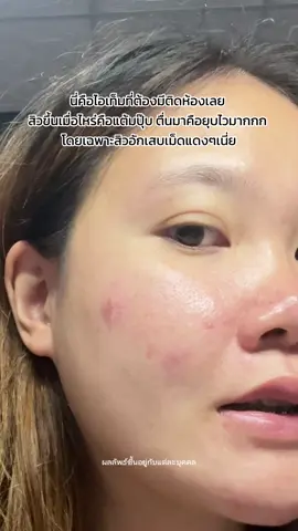 เม็ดแดงๆนี่เดี๋ยวโดน #chubby 