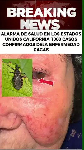 #inmigrantes #usa #latinosenusa #salud 