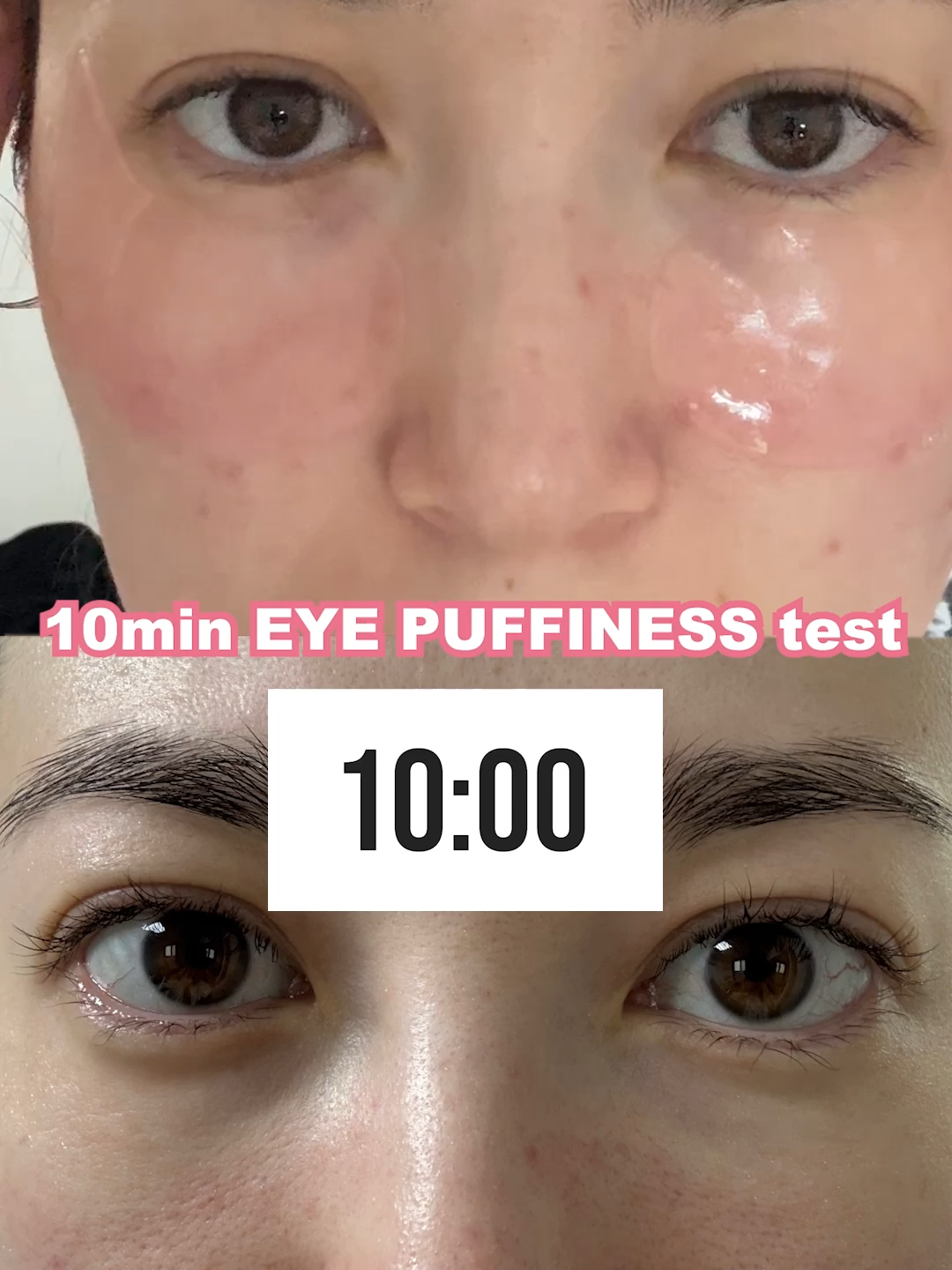 the real 10min eye puffiness test with peptide eye patches 💕 #cosrx #cosrxus #peptideeyepatch #koreanskincare #undereyecircles #viraleyepatches #eyebags #antiaging #puffyeyes