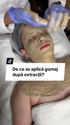 ✨ După extracții, tenul are nevoie de un răsfăț blând și eficient ✨ Gomajul Careless Beauty îndepărtează delicat celulele moarte, lasă pielea fină și luminoasă și pregătește tenul pentru hidratare și regenerare 🌿💆‍♀️ Un pas esențial pentru ca tenul tău să respire și să strălucească natural ✨ #frumusețenaturală #skincareroutine #gomajnatural #cosmeticenaturale 