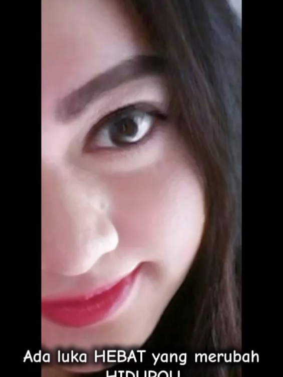 ada luka HEBAT yang merubah hidupqu #fyppppppppppppppppppppppp 