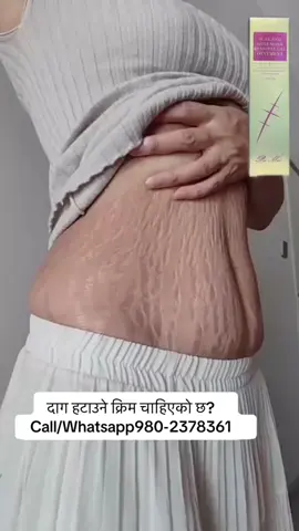 #scar #viralvideo #stretchmarks #musergeneretion 