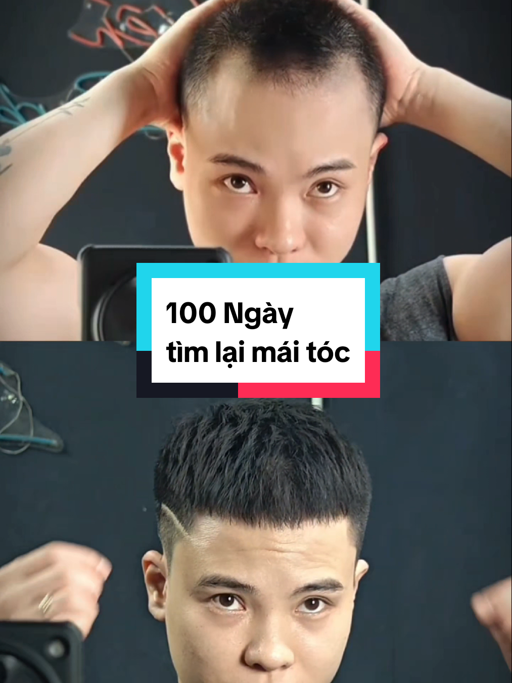 Mất 3 tháng để hoàn thành được video, Ae thả mình quả tim nhé#tienbarber #trihoidau #minoxidil 