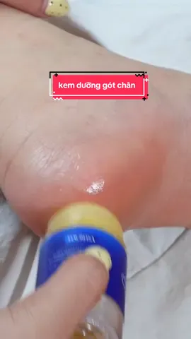 Ai bị khô da chân, nứt gót chân thì xài thử kem dưỡng ẩm kết hợp chà gót chân, da mềm và gót đỡ nứt hơn | Kem dưỡng ẩm gót chân | Nhân check #review #nhancheck 
