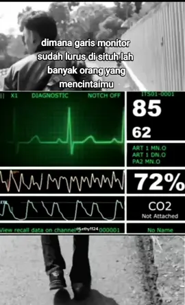 story#story #sadstory #icu #monitor #fyppppppppppppppppppppppp #rs #storiwatsap 