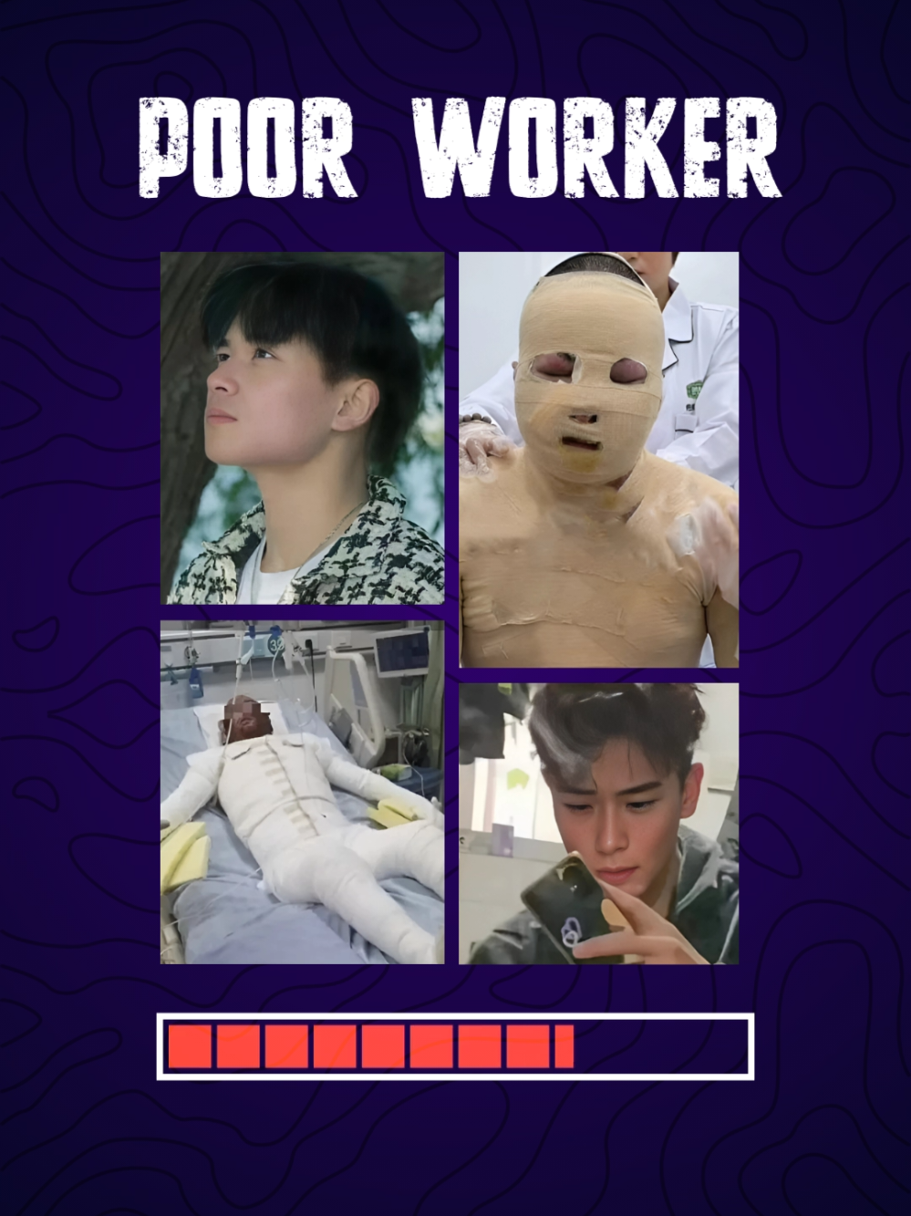 ​The tragic story of the poor worker who faced a horrific acid burn accident. His life was changed forever due to a workplace tragedy and it's a shocking reality we need to talk about. This is a story of a poor worker's bravery and struggle, and a stark reminder of industrial dangers. Every poor worker deserves to be safe at their job. Share his story to demand better safety for all. ​PoorWorker AcidBurn WorkplaceSafety IndustrialAccident Tragedy WorkerSafety SafetyFirst LaborRights PoorWorkerStory FactoryAccident WorkerProtection RealStory #analoghorror #americanhorrorstory #scarystory #horrorstory #creepypasta mystery truescarystory scary horrortok