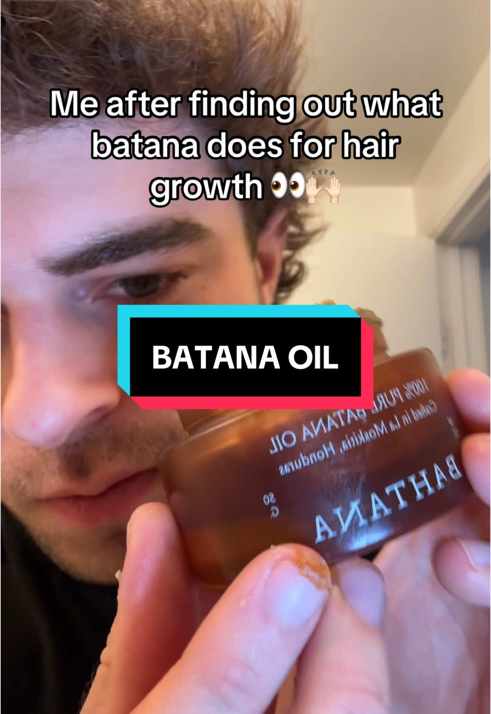 I was actually chopped and looked like a little boy and thought this stuff was just for woman until I found out it can help grow a fuller beard and also help my hairline 😭#BatanaOil #hairgrowth #GlowUp #healthyhair 