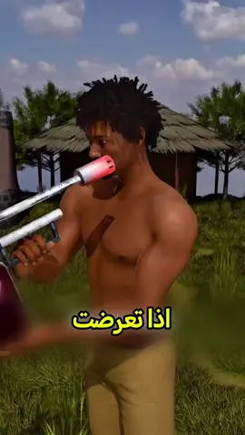 عالج الحروق بأذكى طريقة 😨#معلومات #shorts # #fyoup #youcef98 #تجربة 