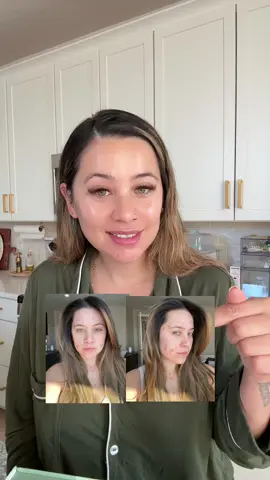 My HOLY GRAIL skincare regiment. I’m so excited to collaborate with @mariniskinsolutions and to share the best products I’ve ever found with all of you! #skincare #skincareroutine #acnetreatment #acneproneskin #acne 