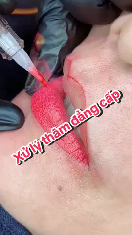 Xử lý thâm đẳng cấp #phunxamthammy #làmđep #livehighlights #phunxamthammy #tmvngochuong 