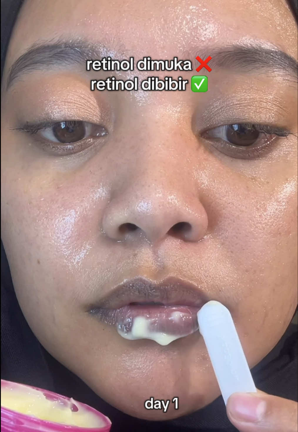 kalau punya retinol ini cuss cobain tips ini 😘💕✨ #fyppppppppppppppppppppppp #retinol #glad2glow #foryoupage #CapCut 