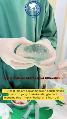 Solusi si kembar gemoy permanen dan membuat tambah percaya diri 😍 #breastimplant#mentor#breastaugmentation#klinikbedahplastik#fypシ 