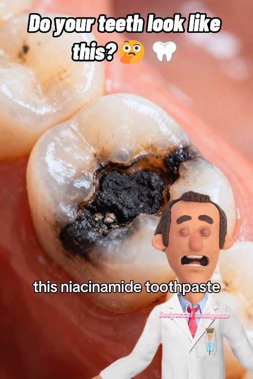 Cracked teeth will lead to sharp pain. #Bodyaccle #toothpaste # #badbreath #teethwhitening #oralhealth #teethcleaning #tiktokmademebuyit #toothpaste #toothpaste #toothwhitening #gingivitis #badbreath #yellowteeth #teeth #tooth #RushTok2025#TikTokShopLaborDaySale#FallFreshness 