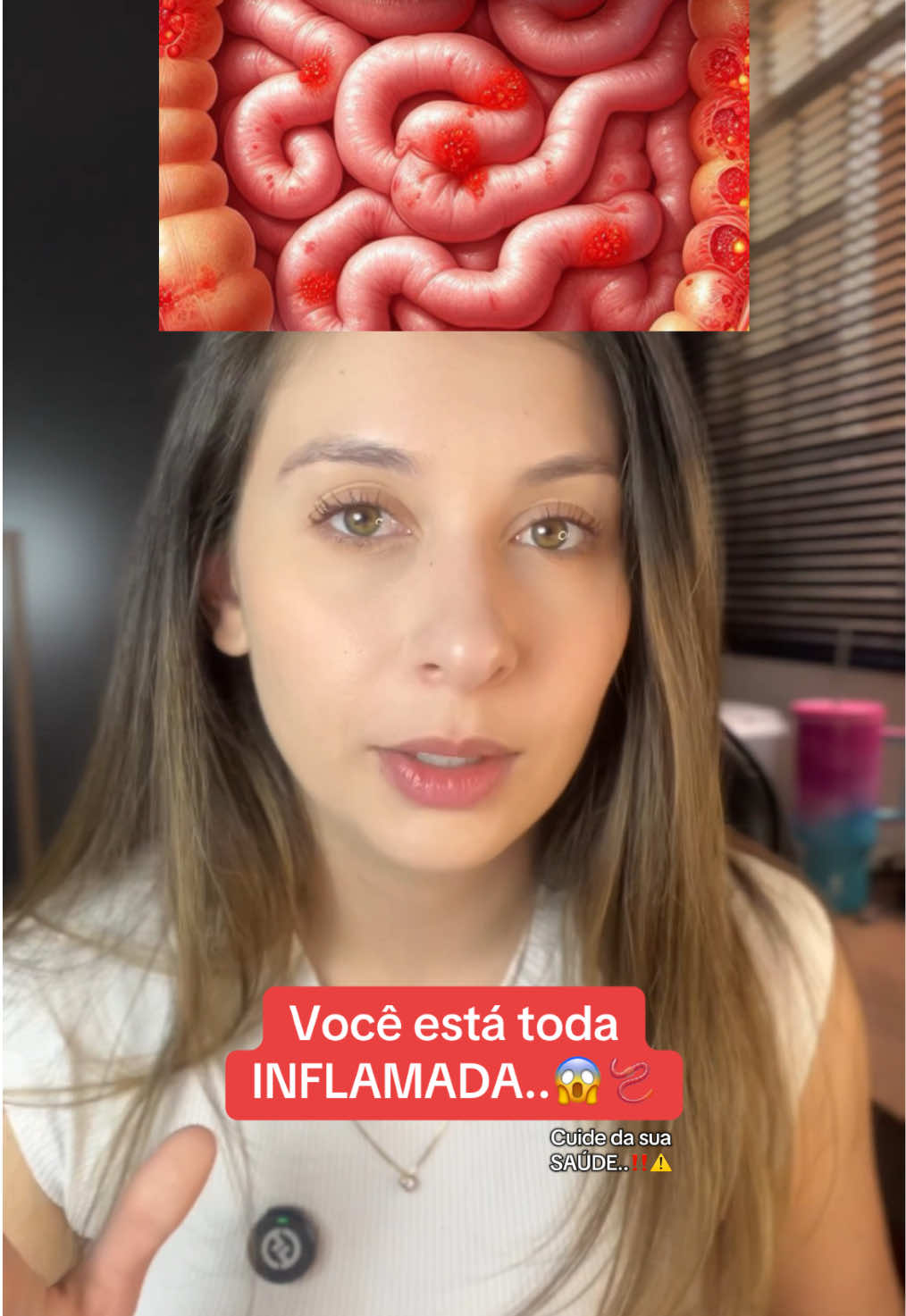 Você está inflamada, e precisa resolver isso agora‼️  #inchaco #inflamacao #intestino #saude #nac 