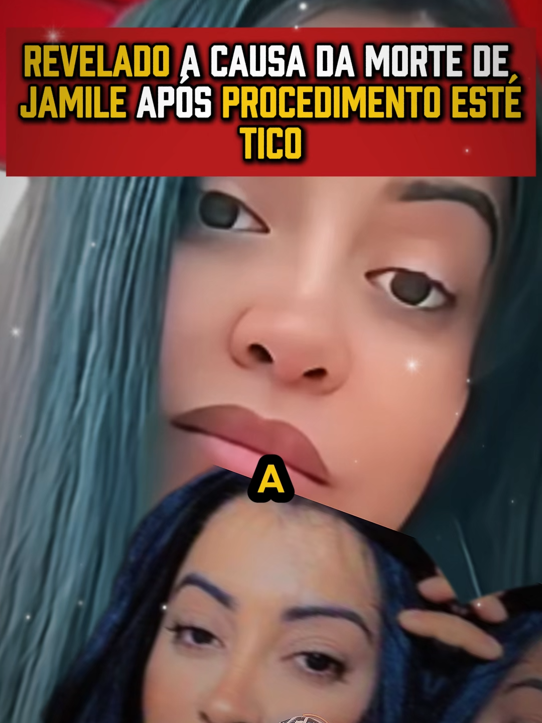 mulher faleceu após aplicar hidrogel, Jamile carvalho, procedimento estetico. #crime #sãovicente #hidrogel #jamilecarvalho