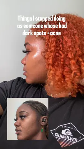 Clear skin isn’t instant. I had to cut back on sugar and dairy, stop picking, and stay consistent. This Turmeric Sea Moss Soap Bar helped fade dark spots and reduce breakouts.  #bodaciousbodybeads #clearskin #turmericsoap #fyp 