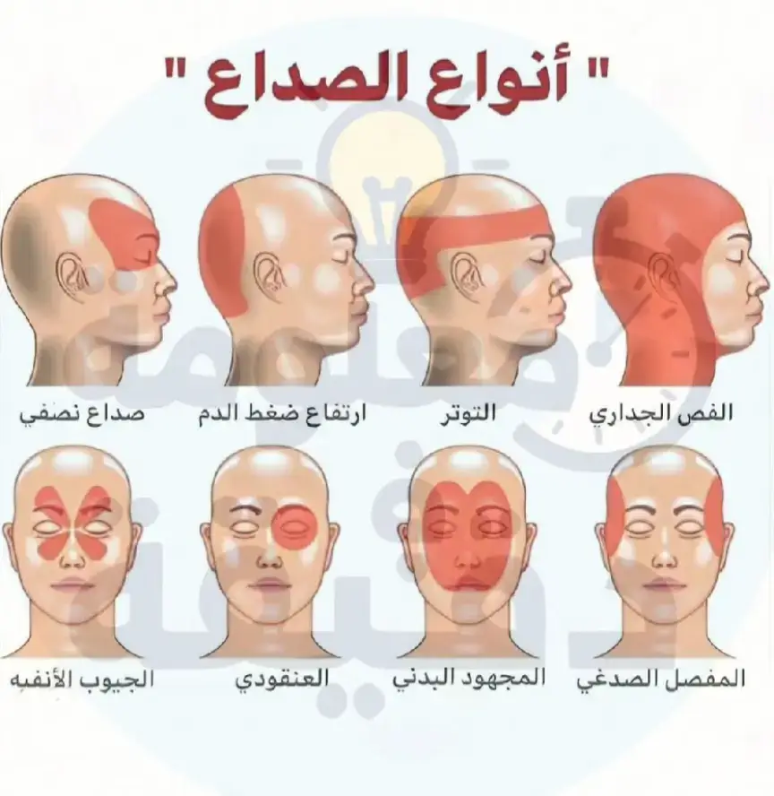 معلومات مهمة  🔴 أنواع الصداع الشائعة: 1️⃣ الصداع التوتري الأكثر شيوعًا. سببه التوتر، قلة النوم، الإرهاق. أعراضه: ضغط أو شد حول الرأس والرقبة. 2️⃣ الصداع النصفي (الشقيقة) يصيب جانب واحد من الرأس. يرافقه غثيان وحساسية للضوء أو الصوت. قد يستمر لساعات أو أيام. 3️⃣ الصداع العنقودي نوبات قصيرة لكنها شديدة جدًا. يتركز الألم حول العين أو جانب الرأس. يتكرر في نفس الوقت يوميًا أو موسميًا. 4️⃣ الصداع الناتج عن الجيوب الأنفية يحدث مع التهاب أو انسداد الجيوب. يزداد الألم عند الانحناء للأمام. 5️⃣ الصداع الناتج عن قلة الكافيين أو الجفاف شائع عند من يتوقف فجأة عن شرب القهوة. أو بسبب قلة شرب الماء. --- ✅ طرق التخلص من الصداع: 🔹 شرب كمية كافية من الماء 💧. 🔹 أخذ قسط كافٍ من النوم 💤. 🔹 الابتعاد عن التوتر والضغط النفسي 🧘. 🔹 تناول وجبات منتظمة وتجنب الجوع لفترات طويلة 🍎. 🔹 ممارسة تمارين الاسترخاء والتنفس العميق. 🔹 وضع كمادات باردة أو دافئة على الرأس حسب نوع الصداع. 🔹 شرب مشروبات طبيعية مثل: الزنجبيل، النعناع، أو القهوة باعتدال. 🔹 استشارة الطبيب عند تكرار أو شدة الصداع لمعرفة السبب الحقيقي. #الصداع #انواع_الصداع #علاج_الصداع #وجع_الراس #الصداع_النصفي