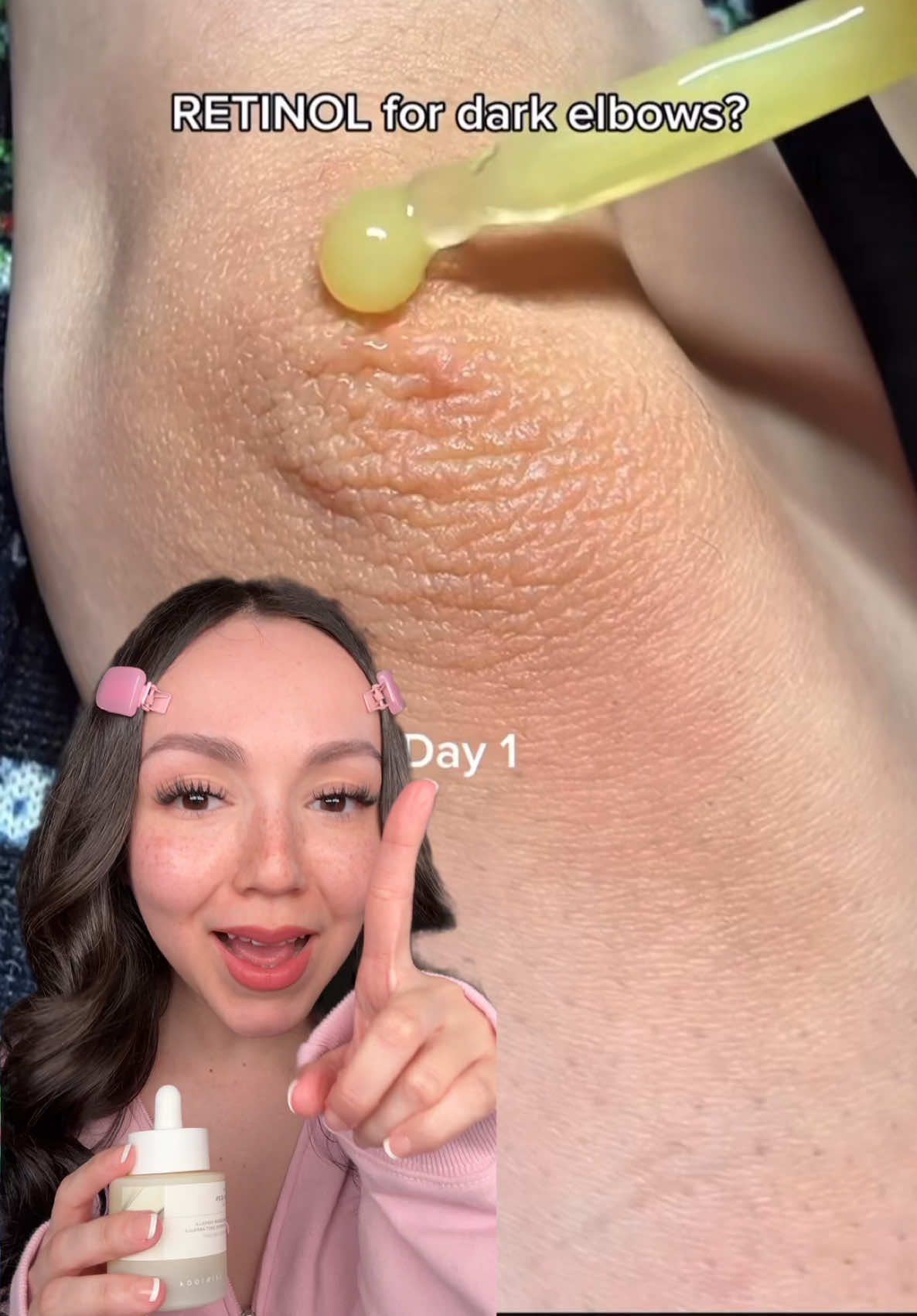 ✨ ¡2 en 1 con el Retinal 0.2% Booster de @SKIN1004 US ✨ Lo uso para el rostro y también para aclarar axilas, codos y rodillas 💛 ¡Resultados visibles y textura increíble! #spicule #spiculeampoule #centella #centellaskincare #skincare        