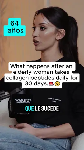 ¿¡Qué pasó después de comer colágeno durante 30 días seguidos!?#fyp #swiyie #collagen #tiktok 