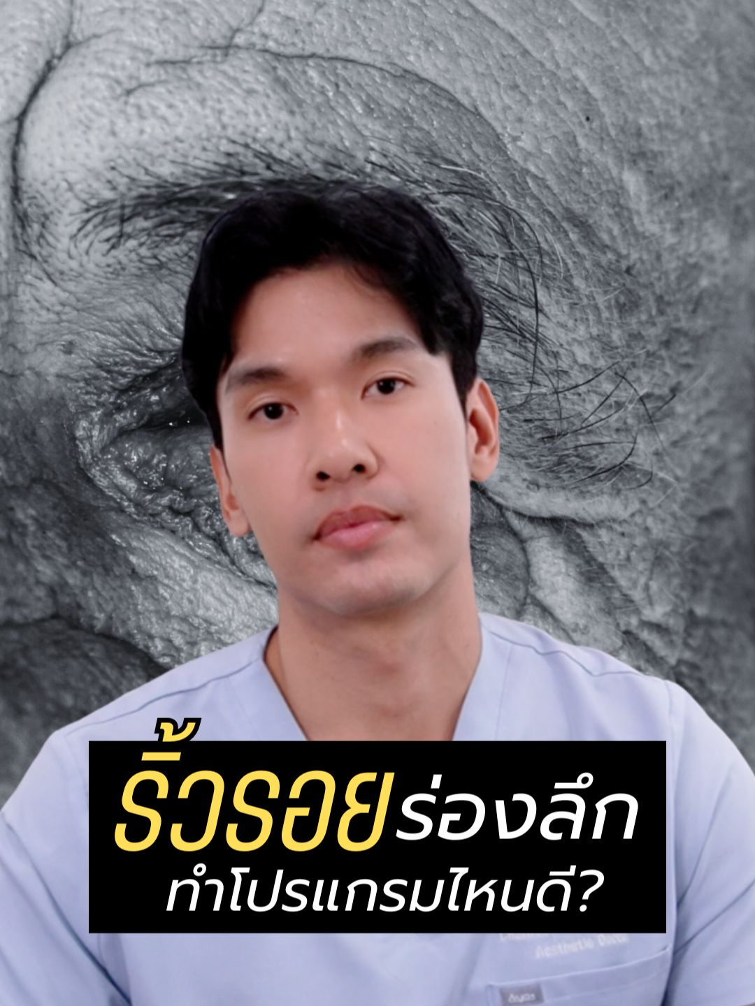มีริ้วรอยเป็นร่องลึกทำโปรแกรมไหนดี ? #smoothclinic #หมอจุ๊ย #ปัญหาผิว #ริ้วรอย #ผิวเหี่ยว