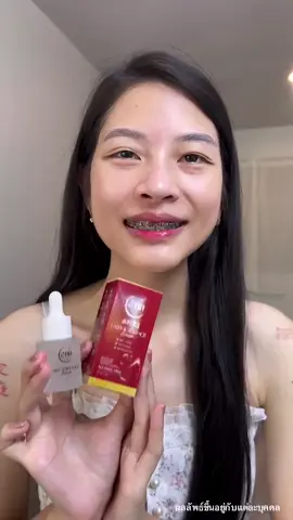 #รีจูรันหน้าใส #ตัวยาเซรั่มรีจูรันbyann #เซรั่มหน้าเด็ก #เซรั่มหน้ากระจก #เซรั่มหน้าใส แอนบิวตี้ฟูลสกินแคร์ กดสั่งสินค้าหน้าโปรไฟล์