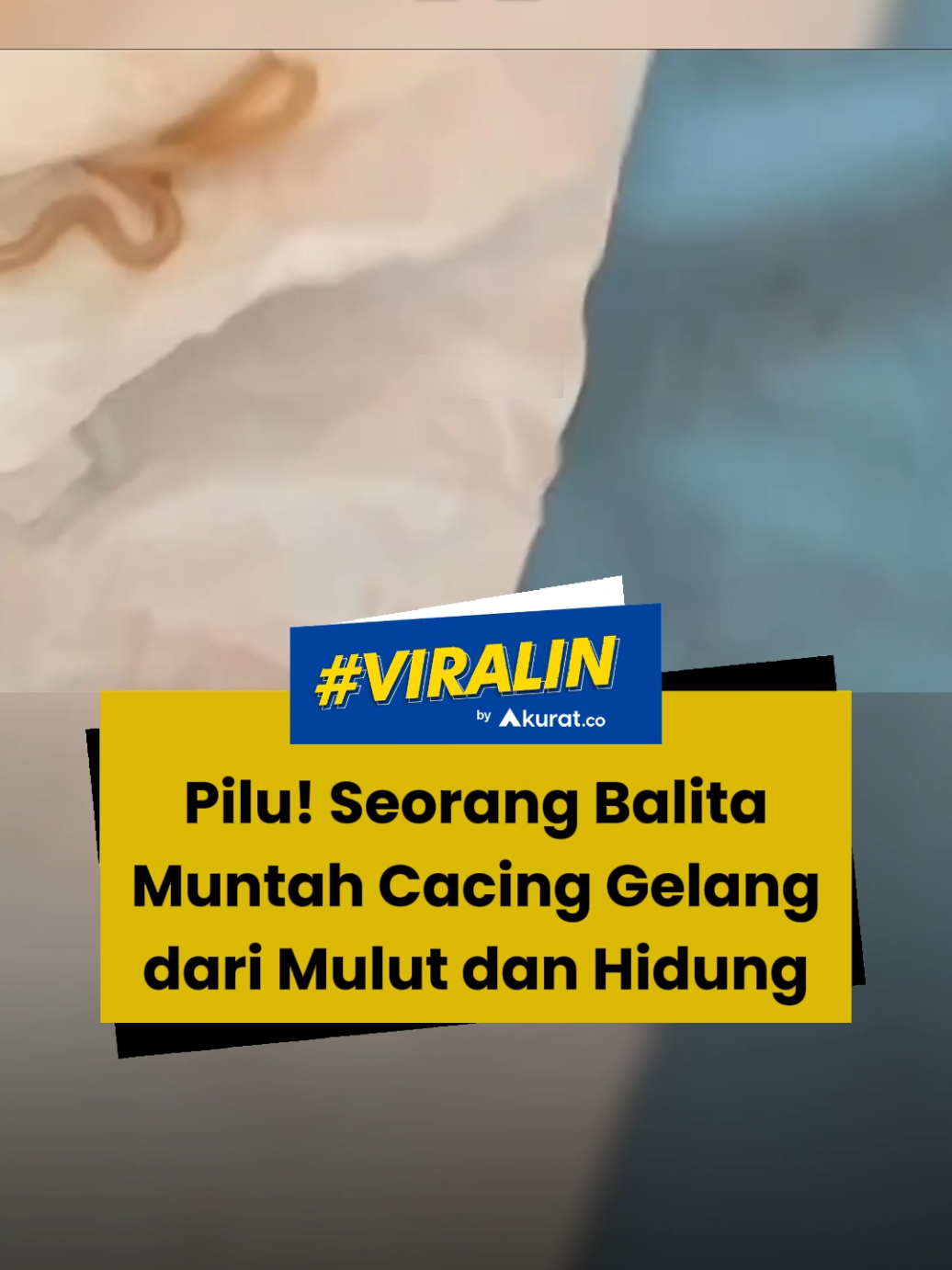 Pihak rumah sakit turut menemukan larva cacing yang bersarang di paru-paru Khaira. Khaira juga didiagnosa mengalami anemia, leukosit tinggi, hingga gula darah yang mencapai 270. Kepala Dinas Kesehatan Kabupaten Seluma, Rudi Syawaludin, mengatakan, Khaira saat ini tengah menjalani penanganan khusus termasuk masalah gizi buruknya. Rudi juga mengatakan Khaira tinggal di rumah yang kurang layak. Lingkungan yang tidak bersih menjadi salah satu faktor Khaira mengalami sakit yang serius. Ayahnya juga memiliki peternakan ayam kampung yang diletakkan tepat di sebelah rumah mereka. Rudi pun turut meminta rumah sakit untuk memeriksa kakak dari Khaira yang berusia 4 tahun. 🎥: Facebook/Arya Gading. #viral #balita #cacingan #sakit #akuratco 