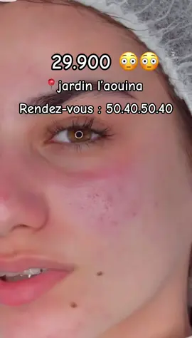#soinvisage #skincare #tunisia🇹🇳 #اكسبلور #foryou