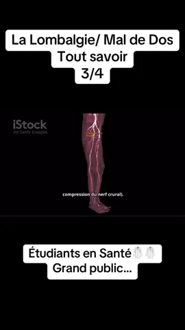 La Lombalgie/Mal de dos 3/4 #vira #france🇫🇷 #ifsi #medecine #infas 