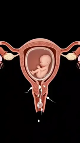 #ivf #fyp #ttc #infertility #baby 