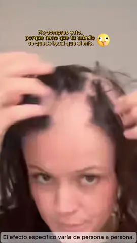 Lo probé y mi cabello dejó de caerse 😱 ¡Increíble!#CuidadoCapilar #crecimientonaturaldelcabello #ShampooAnticaída #hairloss #bald 