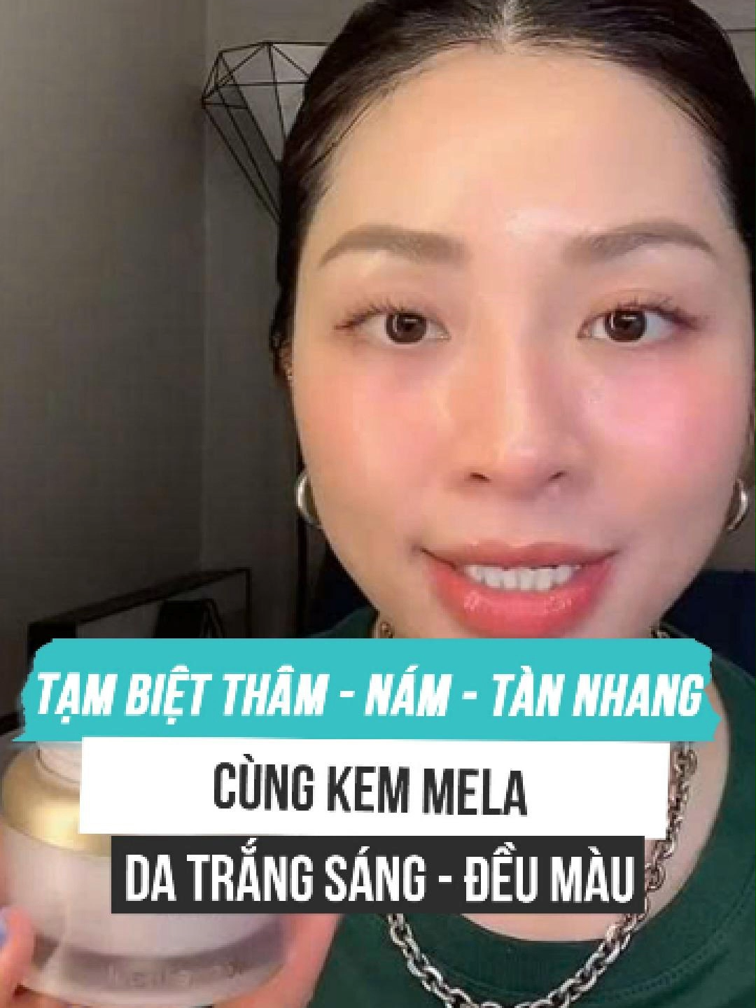 “Mới ngoài 30 mà ai cũng tưởng U50…” Câu nói nghe qua tưởng vô tình, nhưng với phụ nữ đang có nám, nó như một nhát cắt vào lòng các chị nhỉ. Em Vân Anh hiểu, nám không chỉ là những mảng sậm màu trên da, mà còn là cảm giác hụt hẫng mỗi sáng soi gương: - Nhìn khuôn mặt kém tươi, làn da xỉn màu, tự dưng thấy mình già đi hẳn. - Trang điểm đậm cũng không giấu được hết, mà càng che kỹ lại càng lo lớp nền trôi đi. - Ra ngoài thì mất tự tin, ở nhà thì buồn, lúc nào cũng thấy “mình không còn như xưa nữa”. Sự thật là nám không thể biến mất chỉ bằng việc che phủ. Muốn lấy lại sự rạng rỡ, mình cần một giải pháp thực sự “cưng chiều” làn da từ gốc rễ. Kem Nám Mela Vacure:treat chính là người bạn đồng hành em Vân Anh muốn gửi gắm đến chị: ✅Kết cấu nhẹ nhàng, mượt mà, thấm nhanh, mang lại cảm giác thoải mái, không nặng mặt, không bí da. ✅Giúp da nâng tông tự nhiên, sáng khỏe và mịn màng hơn mỗi ngày. ✅Công thức đặc biệt với Tranexamic Acid 2% – Niacinamide 2% – Hydroxyacetophenone – Sodium Hyaluronate 1%: - Hỗ trợ ức chế tyrosinase, giảm hình thành melanin – nguyên nhân gây sạm nám, tàn nhang. - Làm mờ thâm, cải thiện sắc tố, hỗ trợ giảm giãn mao mạch. - Tăng cường hàng rào bảo vệ, giúp da săn chắc, căng mướt và duy trì độ ẩm lâu dài. Sáng hay tối đều dùng được, da khô hay da dầu đều mê. Chỉ cần chăm chỉ 1–2 tháng thôi, chị sẽ thấy làn da trắng hồng, đều màu, những vết thâm sạm cũng dần “bốc hơi”. Em Vân Anh tin rằng: nám có thể làm chị buồn, nhưng không thể đánh cắp tuổi trẻ của mình. Chỉ cần chọn đúng giải pháp, chị sẽ thấy lại hình ảnh một người phụ nữ rạng rỡ, đúng với tuổi thật – và thậm chí còn trẻ trung hơn. #Levananh #myphamlevananh #vacuretreat #kemmela #duongtrang #mothamnam