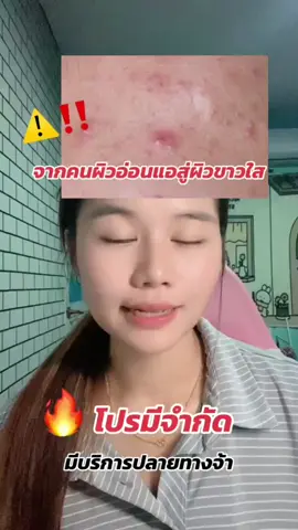 #แชร์วิธีฝ้าจาง #แชร์วิธีสิวหาย #สกินแคร์ไร้สารเคมีสําหรับคนแพ้ง่าย 