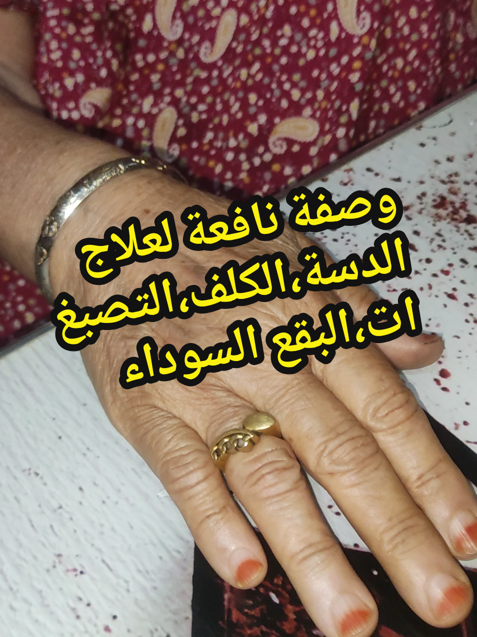 الرد على @bent07..d1  وصفة نافعة لعلاج الدسة،الكلف،التصبغات،البقع السوداء. #ناس_زمان_قالوا  #وصفات_ناس_زمان  #tiktokalgeria  #explore  #dz 