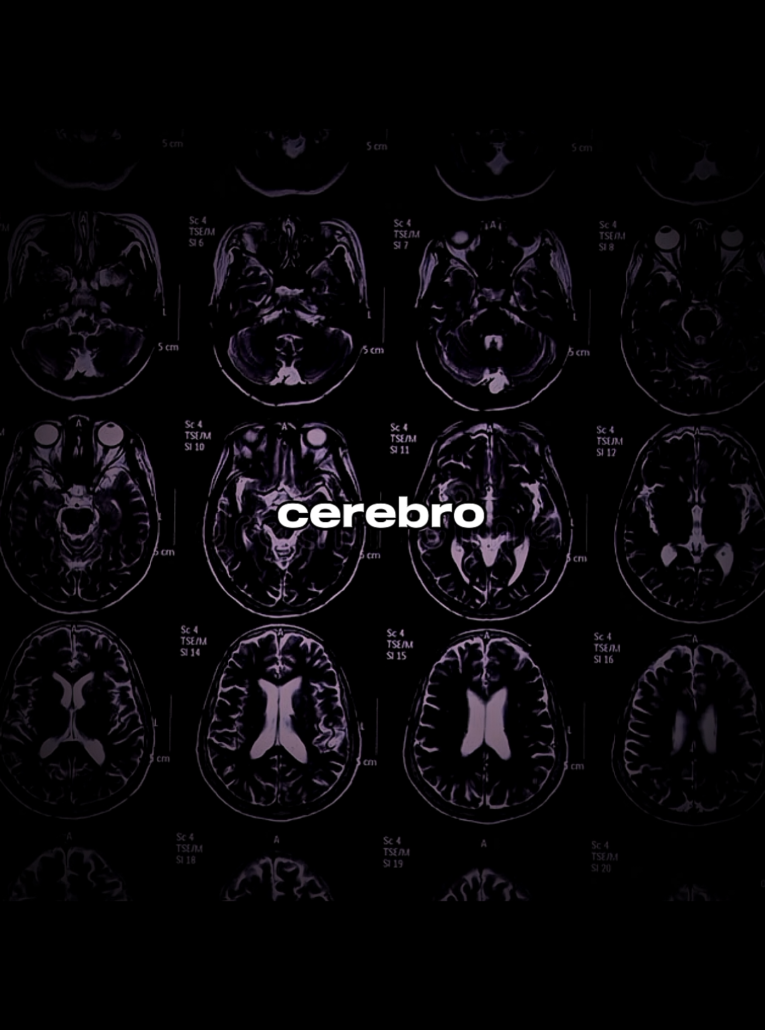 ADICCIÓN A LA ADRENALINA 🧠 #neurociencia #cerebro #psicologia #adrenaline #fyp 