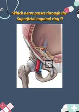 Test your knowledge in Anatomy: Which nerve passes through the superficial inguinal ring? #medical #medicine #medicalstudent #health #Anatomy 