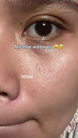 Baru launching tapi udah suka banget sama cleansing oilnya skintific🥹🫶🏻 #cleansingoil #doublecleansing #skintific #komedo #fyp 