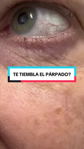 👁️ ¿Por qué carajos te tiembla el párpado sin razón? 1️⃣ No duermes ni madres → luz azul, desveladas, nervios alv. 2️⃣ Café hasta en la sangre → tu ojo baila la macarena. 3️⃣ Estrés → no lo dices, pero tu cuerpo tiembla de coraje. 4️⃣ Deshidratado → sin agua ni electrolitos, hasta el párpado protesta. 5️⃣ Alergias y mugre → tus ojos ya no saben si llorar o patearte. 6️⃣ Dieta jodida → bajo en magnesio, potasio o B12. 👉 Comenta PÁRPADO y te envío GRATIS mi ebook con +200 remedios naturales (solo hoy). Síguenos para optimizar tu salud 🔥 #salud #vidasaludable #consejos #fyp 