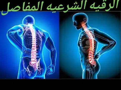 الرقيه الشرعيه المفاصل