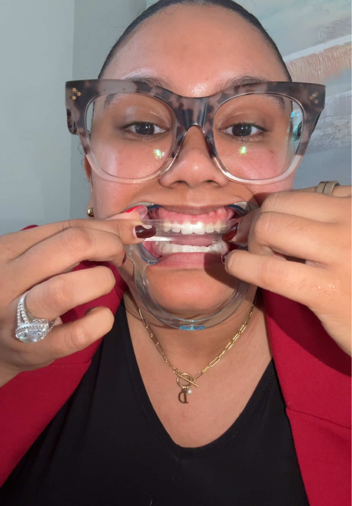 no estamos pa’ andar con dientes amarillentos 🙂‍↔️  #whiteningstrips #teethcare #teethwhitening #blanqueamientodental 