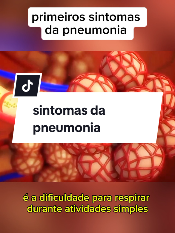 sintomas da pneumonia #saude #pneumonia 