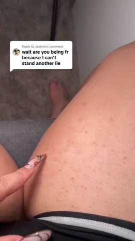 Replying to @Jaslene this ingrown hair serum from @Peach Slices has helped me a lot with the ingrown hairs and dark spots #ingrownhairsolution #ingrownhairtreatment #smoothingtreatment 