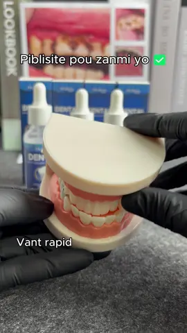 #cavity #yellowteeth #hydroxyapatite #teethhealth #badbreath 